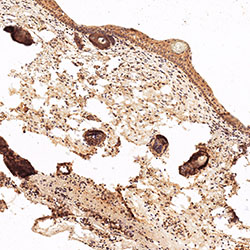 sars-cov-2 gene expression in a human fetus